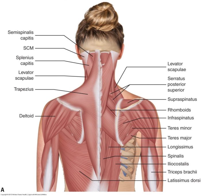 Label the indicated muscles of the head and neck