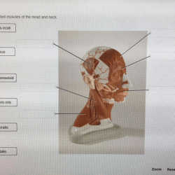 Label the indicated muscles of the head and neck