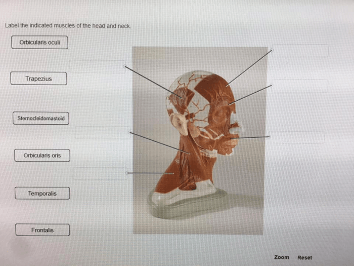 Label the indicated muscles of the head and neck